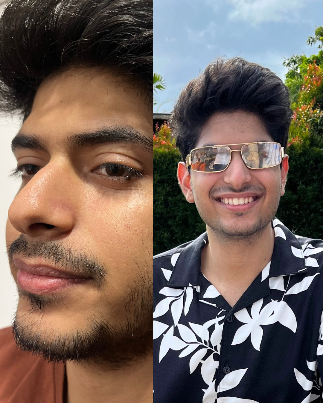 Men clear skin
